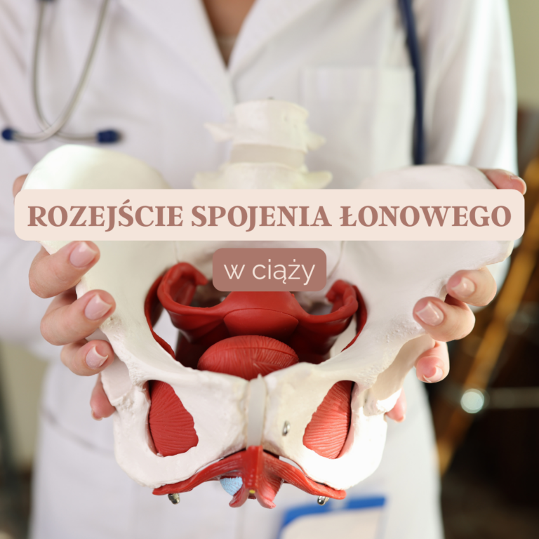 ćwiczenia na rozejście spojenia łonowego pozycja bezpieczna dla kobiet w ciąży trening ciążowy z piłką